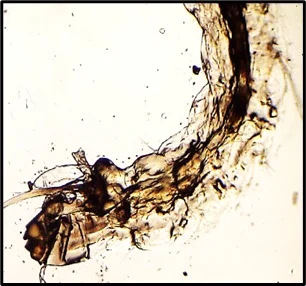 Vector Biology - Posterior Segment
