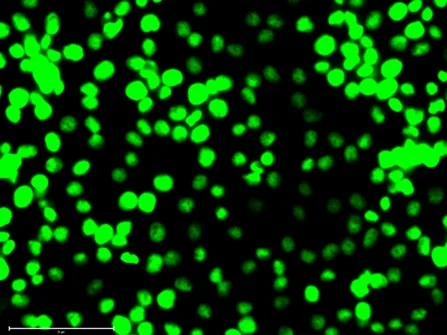 Fluorescence microscopy