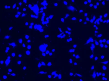 DAPI Fluorescent Blue Nuclear Staining of Cancer Cell Lines