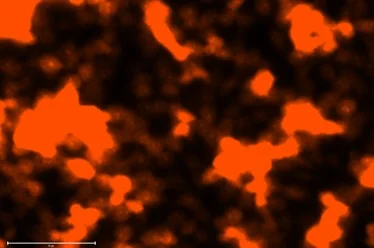 Red/Orange Fluorescence Micrograph Indicating Cell Membrane Damage