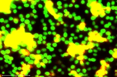 Apoptosis Observation