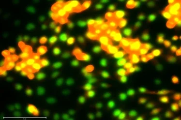 Cancer Biology & Biomedical Research