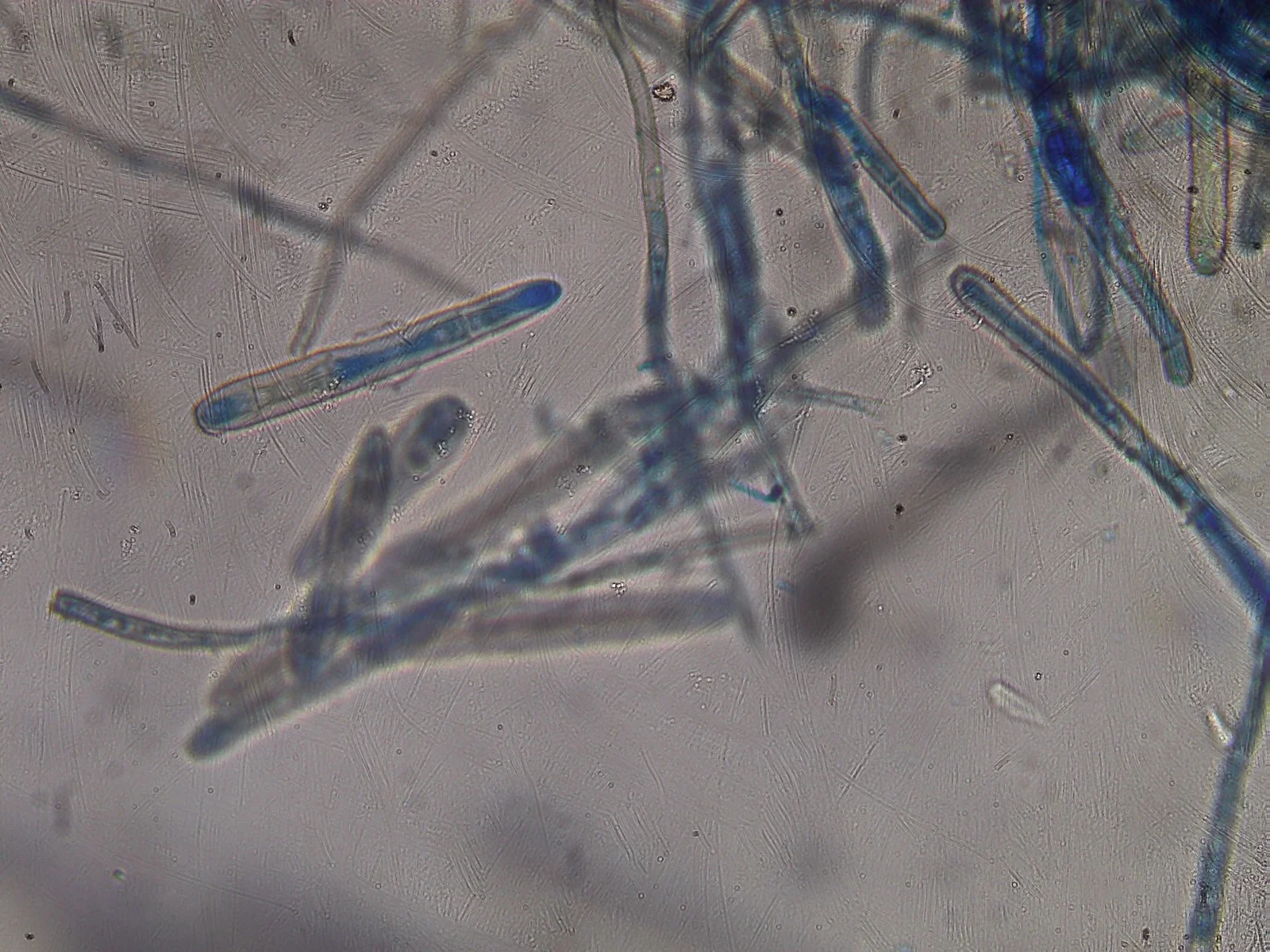Fungal Mycelia Observation